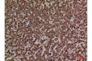 Immunohistochemistry (IHC) image for anti-Adrenomedullin (ADM) (Internal Region) antibody (ABIN6285379)