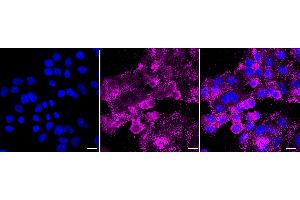 Immunocytochemical staining of HepG2 cells with Histone deacetylase 6 antibody (ABIN7798935), 1:1,000).
