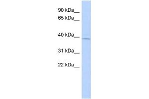 WB Suggested Anti-RP11-217H1. (MAGT1 抗体  (N-Term))