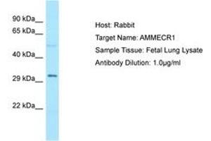 AMMECR1 抗体  (C-Term)