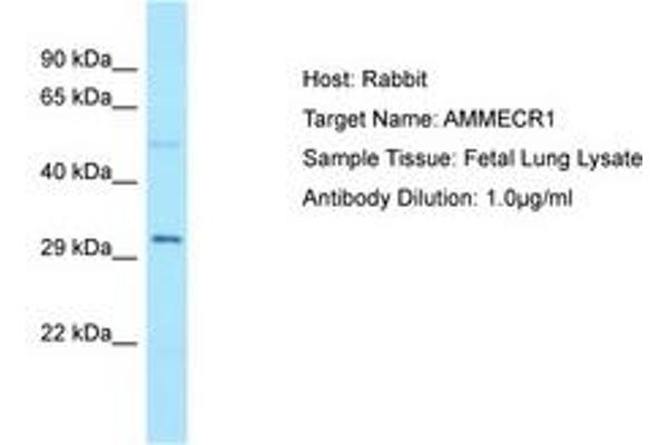 AMMECR1 抗体  (C-Term)