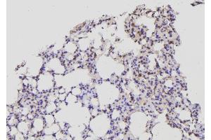 ABIN6269341 at 1/100 staining Mouse lung tissue by IHC-P. (Acetyl-CoA Carboxylase alpha 抗体  (N-Term))