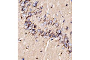 IHC analysis of GPR54/KISS1R using anti-GPR54/KISS1R antibody (ABIN7602153).
