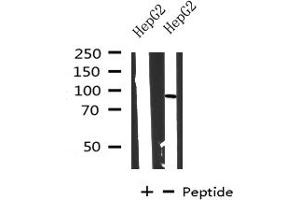 Western blot analysis on HepG2 cells lysate using CPT1A antibody (CPT1A 抗体  (Internal Region))