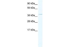 Western Blotting (WB) image for anti-TAF7-Like RNA Polymerase II, TATA Box Binding Protein (TBP)-Associated Factor, 50kDa (TAF7L) (Middle Region) antibody (ABIN2780314)