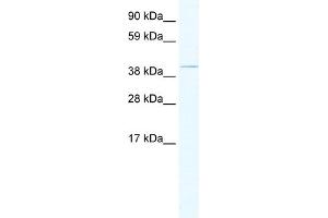 WB Suggested Anti-TAF7L Antibody Titration:  1. (TAF7L 抗体  (Middle Region))