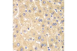 Immunohistochemistry of paraffin-embedded human liver injury using IMPA1 antibody at dilution of 1:100 (x40 lens). (IMPA1 抗体)