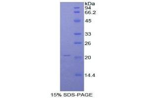 SDS-PAGE (SDS) image for Orosomucoid 1 (ORM1) ELISA Kit (ABIN6574213)