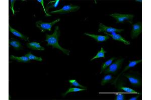 Immunofluorescence of purified MaxPab antibody to TRIT1 on HeLa cell. (TRIT1 抗体  (AA 1-467))