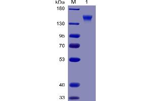 SDS-PAGE (SDS) image for CD96 (CD96) (AA 22-503) protein (mFc-His Tag) (ABIN6961101)