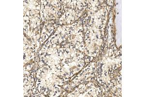 IHC analysis of NXN/NRX using anti-NXN/NRX antibody (ABIN7600416). (NXN 抗体  (AA 19-435))