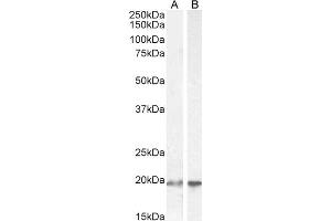 ABIN184805 (2µg/ml) staining of HEK293 (A) and HeLa (B) cell lysate (35µg protein in RIPA buffer). (UBE2C 抗体  (C-Term))