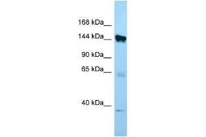 WB Suggested Anti-EMILIN1 Antibody Titration: 1. (Emilin1 抗体  (C-Term))