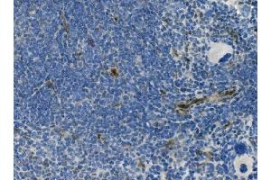 IHC analysis of MCAM using anti-MCAM antibody (ABIN7601026). (MCAM 抗体  (AA 27-621))