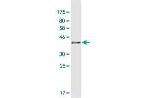 Western Blot detection against Immunogen (41 KDa) . (AKR1CL1 抗体  (AA 1-129))