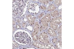 Immunohistochemical staining of human kidney with ATF1 polyclonal antibody  shows moderate nuclear positivity in renal tubules and cells in glomeruli. (AFT1 抗体)