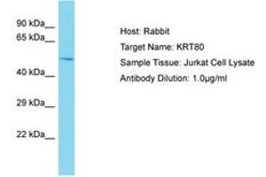 Image no. 1 for anti-Keratin 80 (KRT80) (AA 57-106) antibody (ABIN6750577) (KRT80 抗体  (AA 57-106))