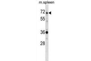 Western Blotting (WB) image for anti-SH3-Domain Binding Protein 2 (SH3BP2) antibody (ABIN2998912) (SH3BP2 抗体)