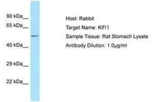 Image no. 1 for anti-Kruppel-Like Factor 11 (KLF11) (N-Term) antibody (ABIN6749845) (KLF11 抗体  (N-Term))