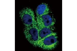 Immunofluorescence (IF) image for anti-Collagen, Type VI, alpha 1 (COL6A1) (AA 831-858), (C-Term) antibody (ABIN390513)