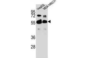 Western Blotting (WB) image for anti-RAP1, GTP-GDP Dissociation Stimulator 1 (RAP1GDS1) antibody (ABIN2996449) (RAP1GDS1 抗体)