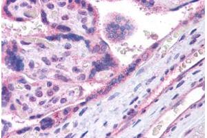 Human Placenta: Formalin-Fixed, Paraffin-Embedded (FFPE) (MAF 抗体  (N-Term))