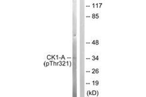 Western blot analysis of extracts from HuvEc cells, using Casein Kinase I alpha (Phospho-Tyr321) Antibody. (CSNK1A1 抗体  (pThr321))
