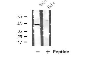 Western blot analysis of extracts from HeLa cells, using CTSD antibody. (Cathepsin D 抗体  (C-Term))