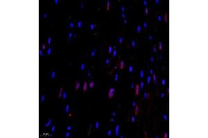 Immunofluorescence of paraffin embedded mouse heart using CITED4 (ABIN7073356) at dilution of 1:2200 (400x lens) (CITED4 抗体)