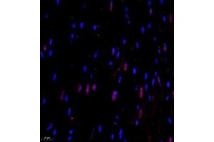 Immunofluorescence of paraffin embedded mouse heart using CITED4 (ABIN7073356) at dilution of 1:2200 (400x lens) (CITED4 抗体)