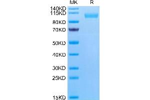 Human CD9P1 on Tris-Bis PAGE under reduced condition. (PTGFRN Protein (AA 26-832) (His tag))