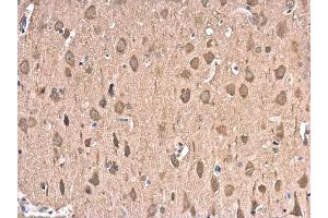 IHC-P Image HSP70 1A antibody detects HSP70 1A protein at cytoplasm in rat brain by immunohistochemical analysis. (HSP70 1A 抗体  (Center))