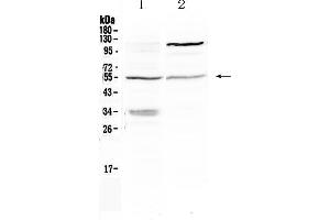 Western blot analysis of ETS1 using anti- ETS1 antibody . (ETS1 抗体  (N-Term))
