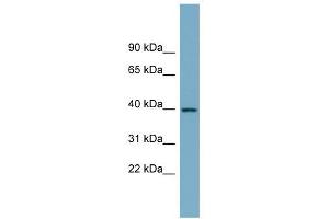 SULT2B1 antibody used at 1 ug/ml to detect target protein. (SULT2B1 抗体  (N-Term))