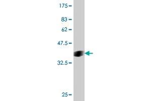 Western Blotting (WB) image for anti-SMAD Specific E3 Ubiquitin Protein Ligase 1 (SMURF1) (AA 165-268) antibody (ABIN566098)