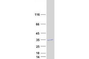 Validation with Western Blot (GOSR2 Protein (Transcript Variant A) (Myc-DYKDDDDK Tag))