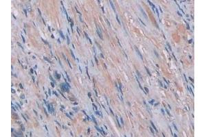 Detection of IL1a in Human Prostate Tissue using Monoclonal Antibody to Interleukin 1 Alpha (IL1a) (IL1A 抗体  (AA 113-271))