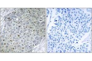 Immunohistochemistry (IHC) image for anti-Ets Variant 4 (ETV4) (AA 281-330) antibody (ABIN2889480) (ETV4 抗体  (AA 281-330))