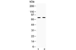 Western blot testing of 1) rat thymus and 2) human COLO320 lysate with TRF2 antibody at 0. (TRF2 抗体)