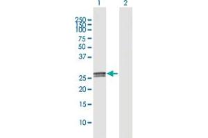 Western Blotting (WB) image for anti-Complement Component 1, Q Subcomponent, A Chain (C1QA) (AA 1-245) antibody (ABIN513850)