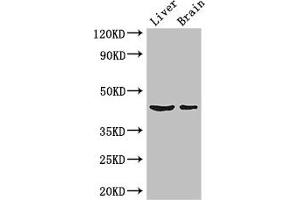 Western Blot Positive WB detected in: Mouse liver tissue, Mouse brain tissue All lanes: METTL2A antibody at 3 μg/mL Secondary Goat polyclonal to rabbit IgG at 1/50000 dilution Predicted band size: 44, 28 kDa Observed band size: 44 kDa