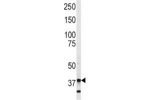 Western Blotting (WB) image for anti-Annexin A5 (ANXA5) (AA 262-291) antibody (ABIN3002694) (Annexin V 抗体  (AA 262-291))