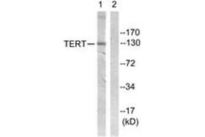 Western blot analysis of extracts from Jurkat cells, using Telomerase (Ab-824) Antibody. (TERT 抗体  (AA 796-845))
