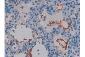 DAB staining on IHC-P; Samples: Rat Lung Tissue (Thrombomodulin 抗体  (AA 31-167))