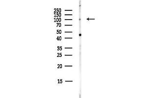 Western blot analysis of lysates from COLO205 cells(heat-shock,45 min treatment), using VRL1 Antibody at 1/1000 dilution.