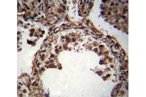 TUBA1C antibody immunohistochemistry analysis in formalin fixed and paraffin embedded human lung tissue. (TUBA1C 抗体  (AA 414-441))