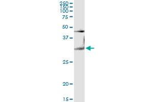 Western Blotting (WB) image for anti-Galectin 3 (LGALS3) (AA 1-250) antibody (ABIN517488)