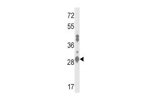 Western blot analysis of GSTA2 Antibody (N-term) (ABIN653362 and ABIN2842838) in MDA-M cell line lysates (35 μg/lane).
