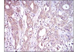 Immunohistochemistry (IHC) image for anti-CD93 (CD93) (AA 474-535) antibody (ABIN1724908)