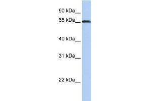WB Suggested Anti-ZXDC Antibody Titration:  0. (ZXDC 抗体  (Middle Region))